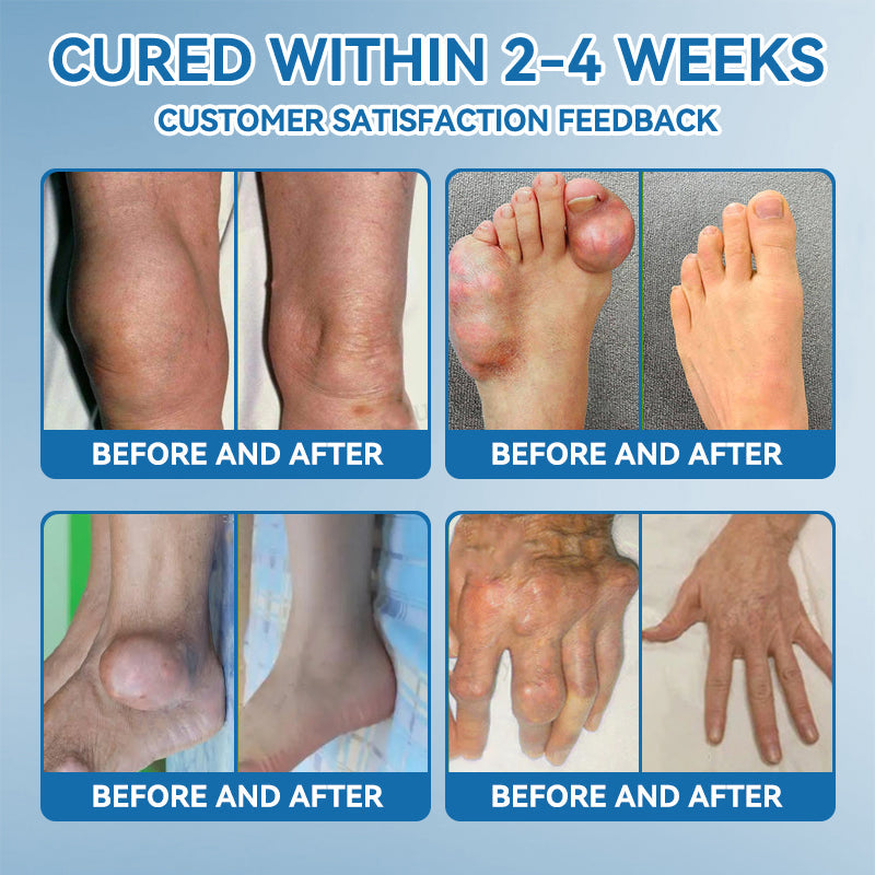 𝐋𝐢𝐩𝐌𝐚𝐩𝐬® BPC-157 Joint & Gout Relief Cream🦴Treats Arthritis, Neuropathy, Rheumatism, Sports Injuries & More