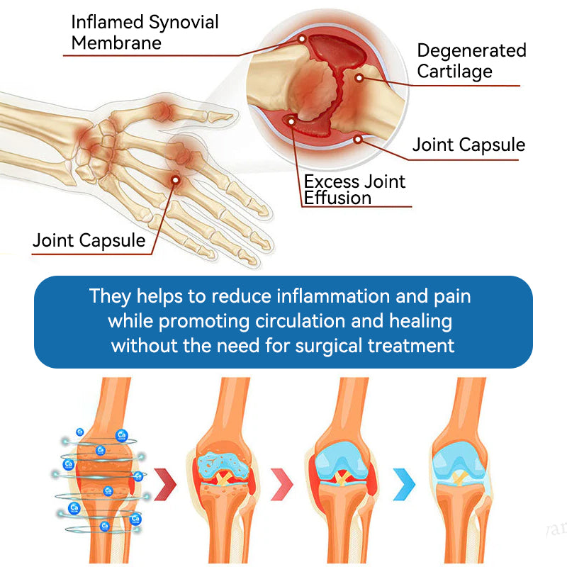 𝐋𝐢𝐩𝐌𝐚𝐩𝐬® BPC-157 Joint & Gout Relief Cream🦴Treats Arthritis, Neuropathy, Rheumatism, Sports Injuries & More