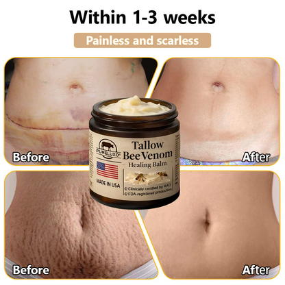 【80% OFF Ends Today】Pureluxo® 🐄Tallow Bee Venom Healing Balm（Targets Bumps, Wrinkles & Stressed Skin — Without Steroids）