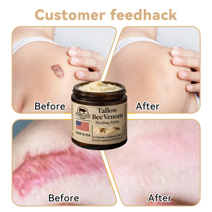 【80% OFF Ends Today】Pureluxo® 🐄Tallow Bee Venom Healing Balm（Targets Bumps, Wrinkles & Stressed Skin — Without Steroids）