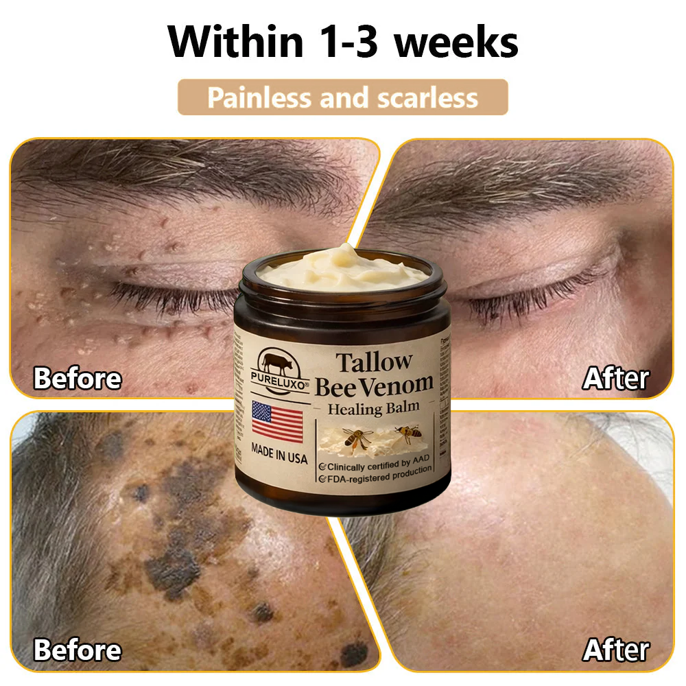 【80% OFF Ends Today】Pureluxo® 🐄Tallow Bee Venom Healing Balm（Targets Bumps, Wrinkles & Stressed Skin — Without Steroids）