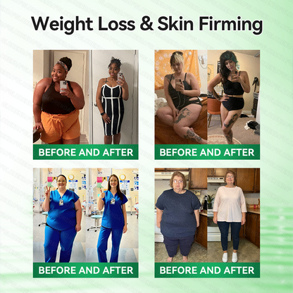 [FDA-Registered & Clinical support] 🇺🇸 𝙋𝙪𝙧𝙚𝙡𝙪𝙭𝙤® L-Carnitine × Retinol | Slimming & Firming 2-in-1 Nano Microneedle Patch 🔥 Obesity, Diabetes, Sleep Apnea, And Joint Issues⏳