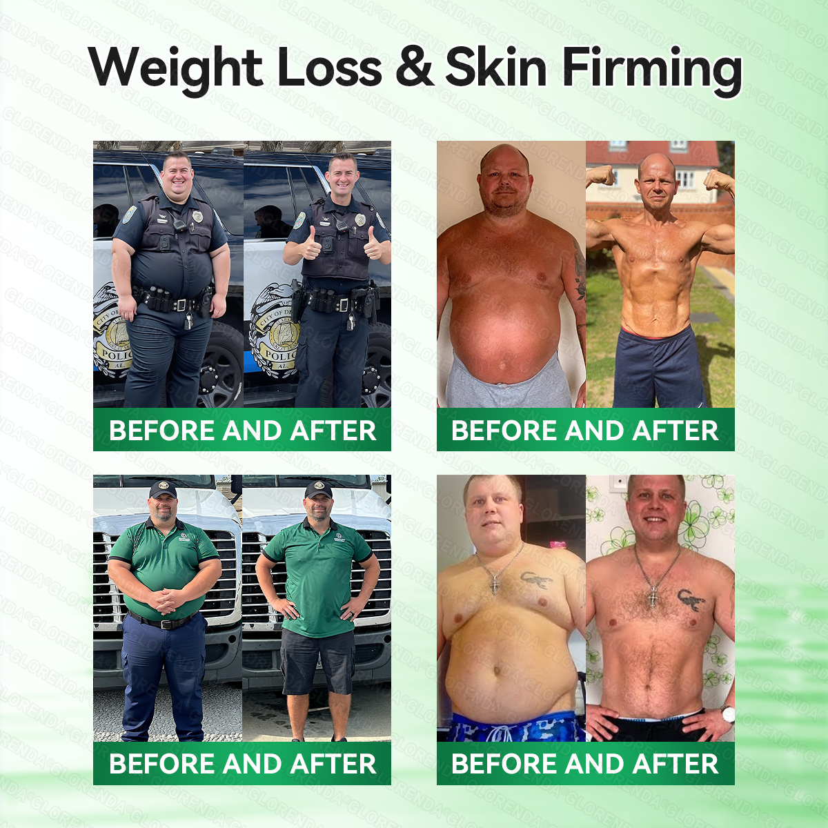 [FDA-Registered & Clinical support] 🇺🇸 𝙋𝙪𝙧𝙚𝙡𝙪𝙭𝙤® L-Carnitine × Retinol | Slimming & Firming 2-in-1 Nano Microneedle Patch 🔥 Obesity, Diabetes, Sleep Apnea, And Joint Issues⏳