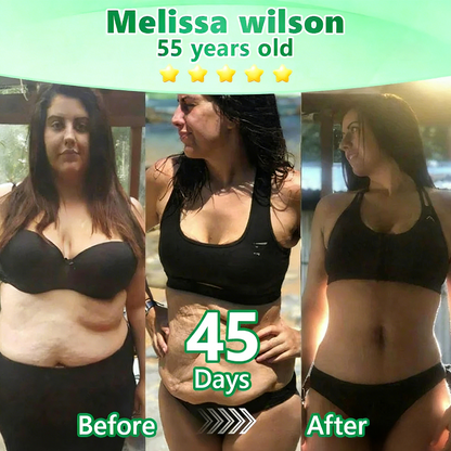 [FDA-Registered & Clinical support] 🇺🇸 𝙋𝙪𝙧𝙚𝙡𝙪𝙭𝙤® L-Carnitine × Retinol | Slimming & Firming 2-in-1 Nano Microneedle Patch 🔥 Obesity, Diabetes, Sleep Apnea, And Joint Issues⏳