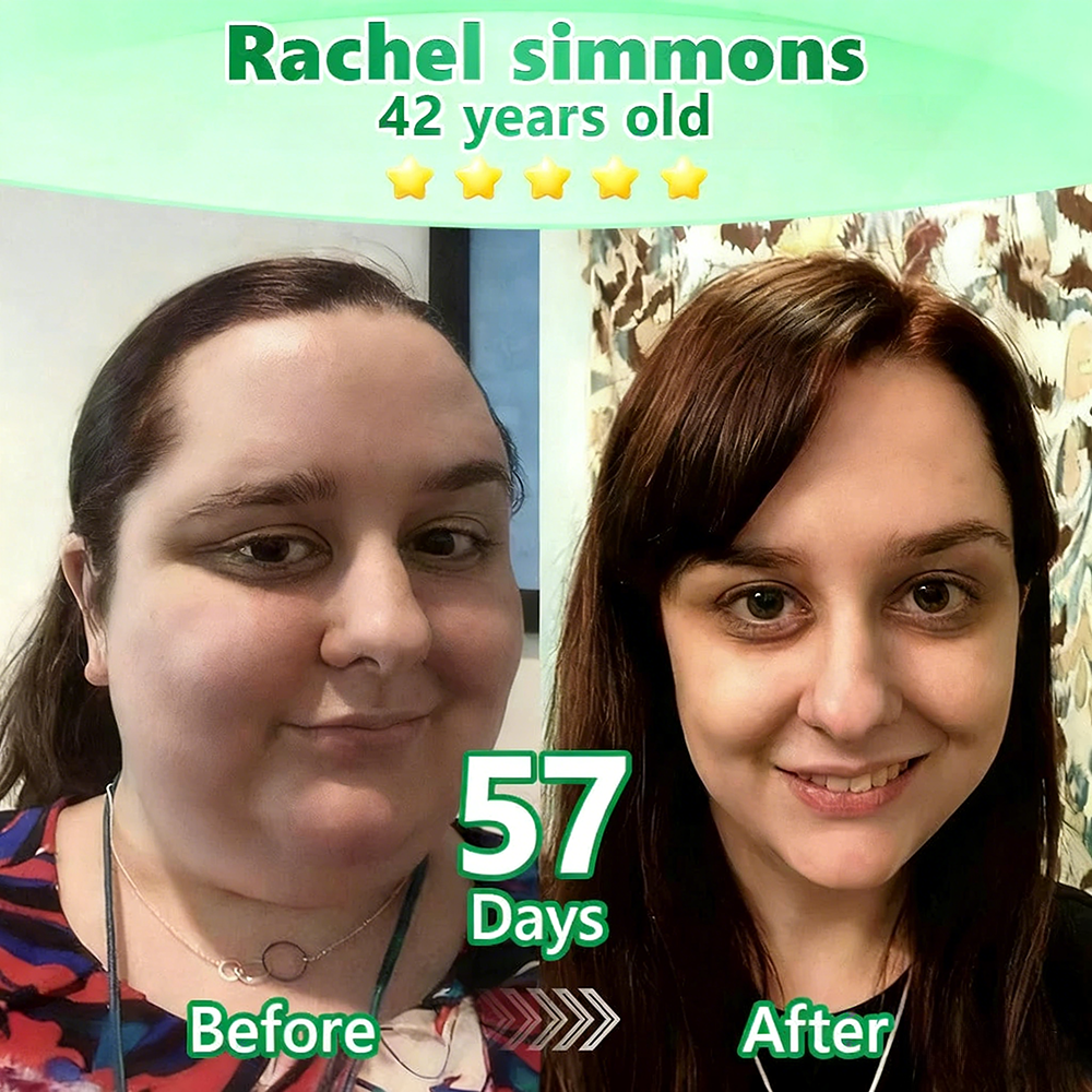 [FDA-Registered & Clinical support] 🇺🇸 𝙋𝙪𝙧𝙚𝙡𝙪𝙭𝙤® L-Carnitine × Retinol | Slimming & Firming 2-in-1 Nano Microneedle Patch 🔥 Obesity, Diabetes, Sleep Apnea, And Joint Issues⏳