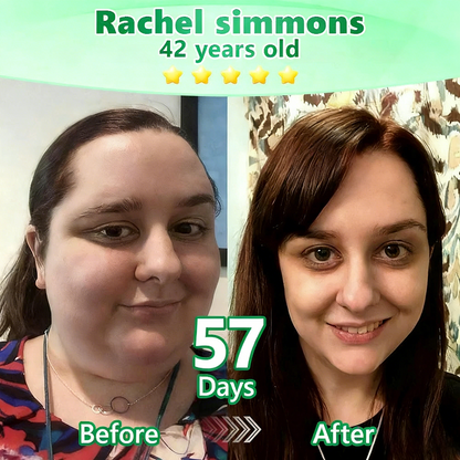 [FDA-Registered & Clinical support] 🇺🇸 𝙋𝙪𝙧𝙚𝙡𝙪𝙭𝙤® L-Carnitine × Retinol | Slimming & Firming 2-in-1 Nano Microneedle Patch 🔥 Obesity, Diabetes, Sleep Apnea, And Joint Issues⏳