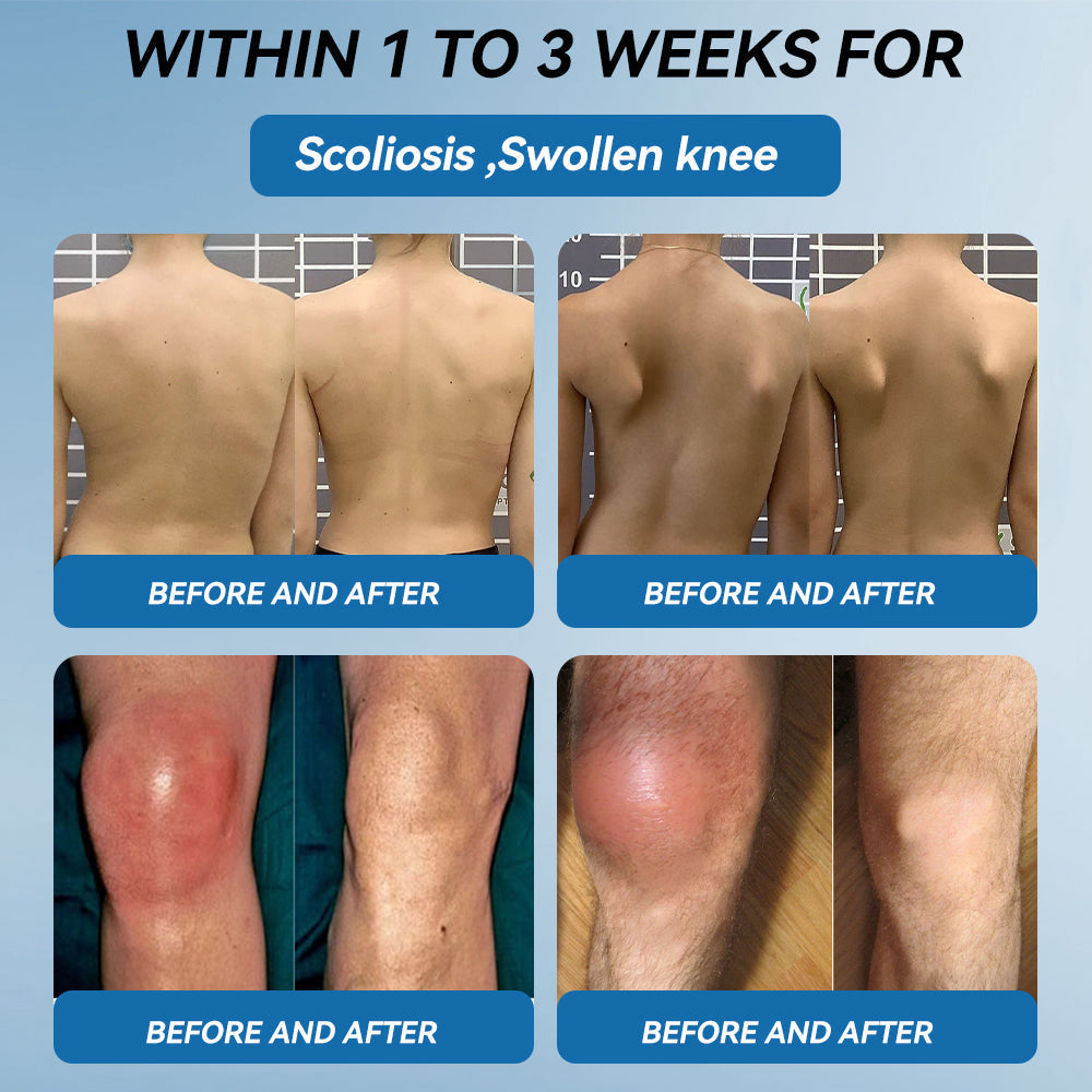 𝐋𝐢𝐩𝐌𝐚𝐩𝐬® BPC-157 Joint & Gout Relief Cream🦴Treats Arthritis, Neuropathy, Rheumatism, Sports Injuries & More