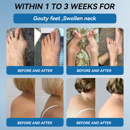 𝐋𝐢𝐩𝐌𝐚𝐩𝐬® BPC-157 Joint & Gout Relief Cream🦴Treats Arthritis, Neuropathy, Rheumatism, Sports Injuries & More