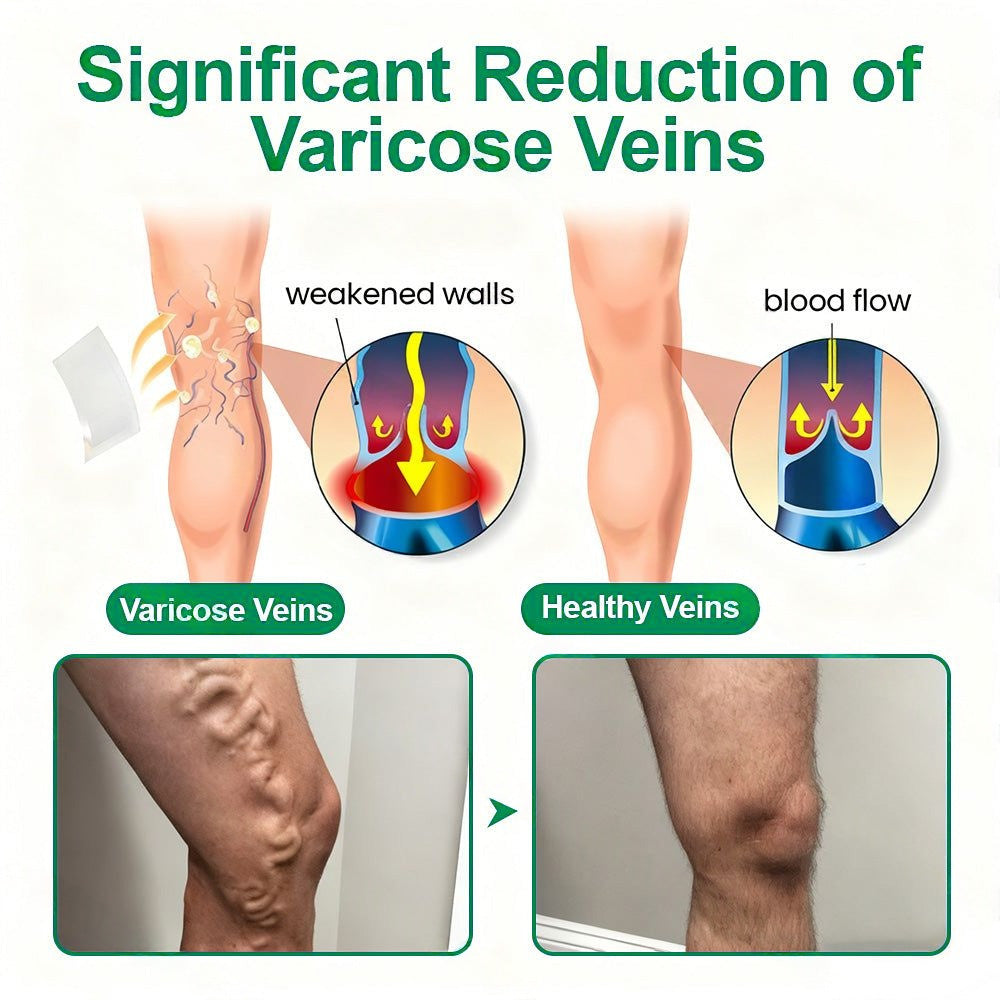 🇺🇸[FDA-Registered & GMP Certified]| 𝙋𝙪𝙧𝙚𝙡𝙪𝙭𝙤® VeinTarget Microneedle Patch⚡Instant Relief, Long-Term Results