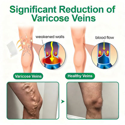 🇺🇸[FDA-Registered & GMP Certified]| 𝙋𝙪𝙧𝙚𝙡𝙪𝙭𝙤® VeinTarget Microneedle Patch⚡Instant Relief, Long-Term Results