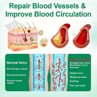🇺🇸[FDA-Registered & GMP Certified]| 𝙋𝙪𝙧𝙚𝙡𝙪𝙭𝙤® VeinTarget Microneedle Patch⚡Instant Relief, Long-Term Results