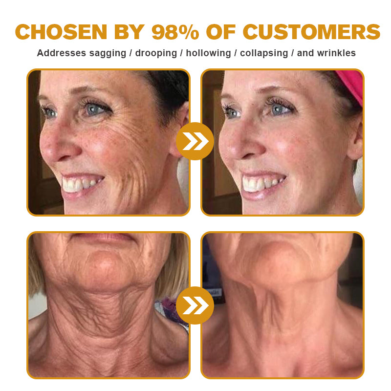 Pureluxo® Botox Bee Venom Wrinkle Removal Cream- LAST DAY 70% OFF🔥