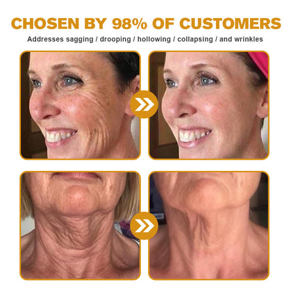 Pureluxo® Botox Bee Venom Wrinkle Removal Cream- LAST DAY 70% OFF🔥