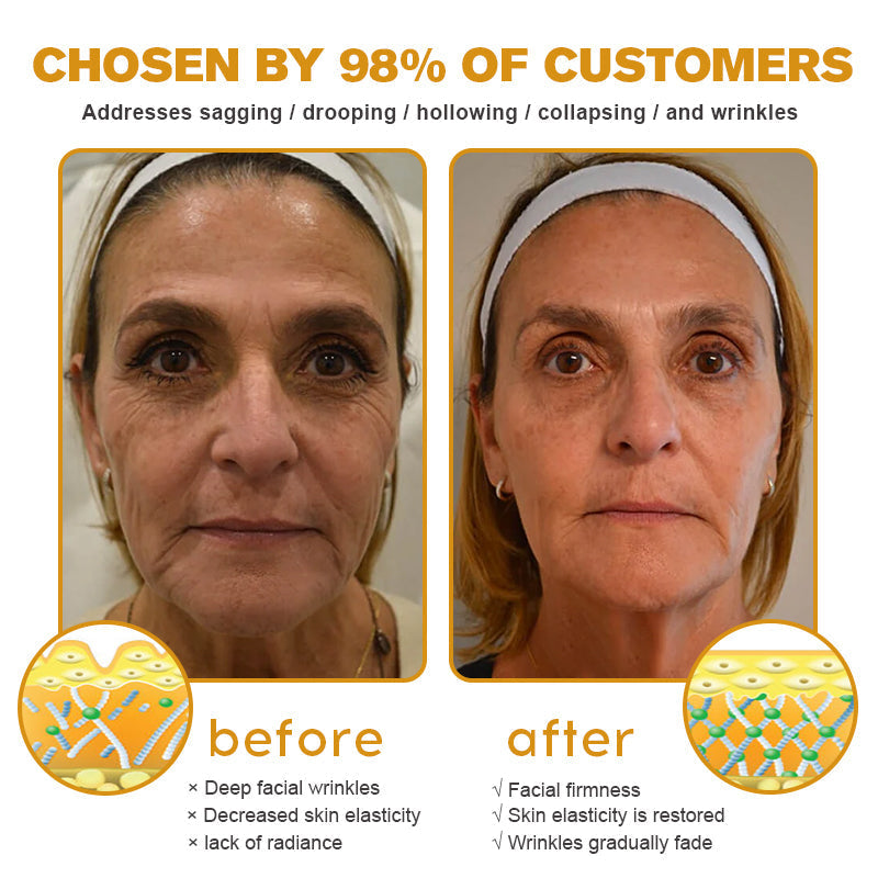 Pureluxo® Botox Bee Venom Wrinkle Removal Cream- LAST DAY 70% OFF🔥