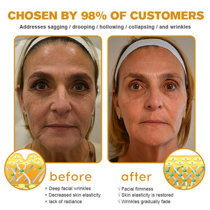Pureluxo® Botox Bee Venom Wrinkle Removal Cream- LAST DAY 70% OFF🔥